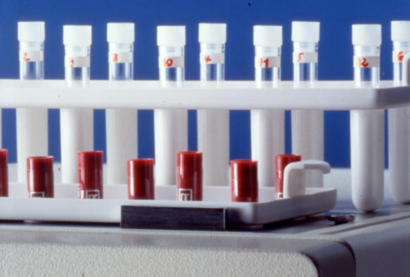 Multi Crystal LB 2111 is a instrument optimized for IRMA and RIA immunoassays based on gamma-emitting isotopes like 125I, 57Co, 59Fe, 51Cr, 99Tc.